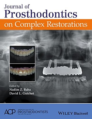 Read Journal of Prosthodontics on Complex Restorations - Nadim Z. Baba | PDF